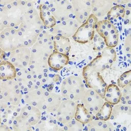 Anti-MTERFD3 antibody used in IHC (Paraffin sections) (IHC-P). GTX65932