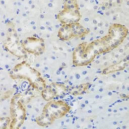 Anti-MTERFD3 antibody used in IHC (Paraffin sections) (IHC-P). GTX65932