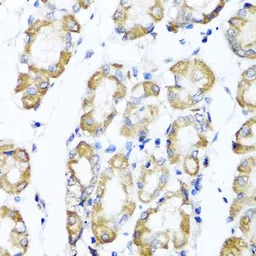 Anti-ST6GAL1 antibody used in IHC (Paraffin sections) (IHC-P). GTX65933