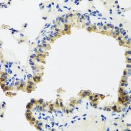 Anti-ST6GAL1 antibody used in IHC (Paraffin sections) (IHC-P). GTX65933