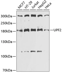 Anti-Rent2 antibody used in Western Blot (WB). GTX65934