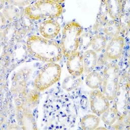 Anti-Rent2 antibody used in IHC (Paraffin sections) (IHC-P). GTX65934