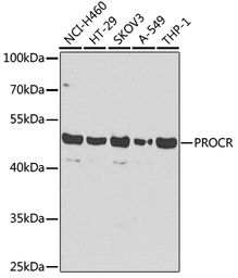 Anti-EPCR antibody used in Western Blot (WB). GTX65935