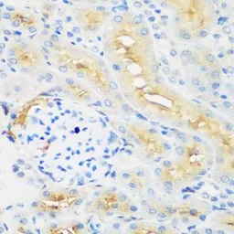 Anti-EPCR antibody used in IHC (Paraffin sections) (IHC-P). GTX65935