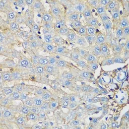 Anti-EPCR antibody used in IHC (Paraffin sections) (IHC-P). GTX65935
