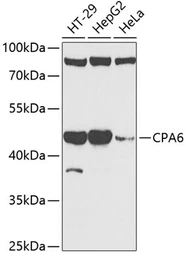 Anti-CPA6 antibody used in Western Blot (WB). GTX65936