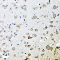 Anti-CPA6 antibody used in IHC (Paraffin sections) (IHC-P). GTX65936