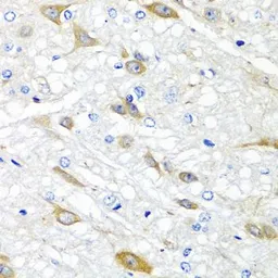 Anti-CPA6 antibody used in IHC (Paraffin sections) (IHC-P). GTX65936