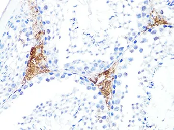 Anti-S100A10 antibody used in IHC (Paraffin sections) (IHC-P). GTX65938