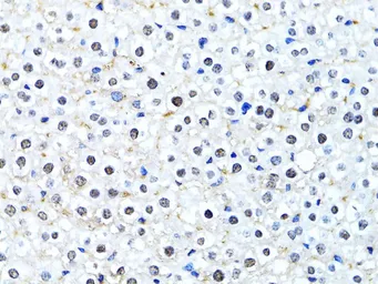 Anti-HIST2H2BE antibody used in IHC (Paraffin sections) (IHC-P). GTX65940