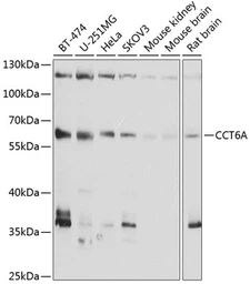 Anti-TCP1 zeta antibody used in Western Blot (WB). GTX65941