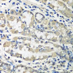 Anti-TCP1 zeta antibody used in IHC (Paraffin sections) (IHC-P). GTX65941