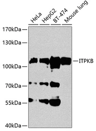 Anti-ITPKB antibody used in Western Blot (WB). GTX65942