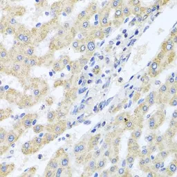 Anti-ITPKB antibody used in IHC (Paraffin sections) (IHC-P). GTX65942