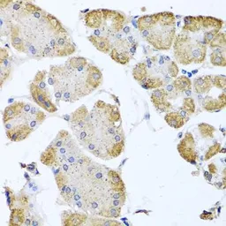Anti-ITPKB antibody used in IHC (Paraffin sections) (IHC-P). GTX65942
