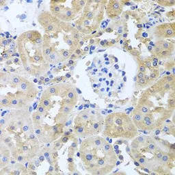 Anti-ITPKB antibody used in IHC (Paraffin sections) (IHC-P). GTX65942