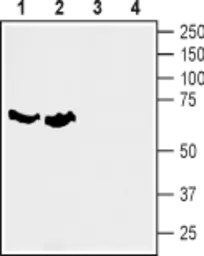 Anti-SLC6A7 antibody used in Western Blot (WB). GTX65943