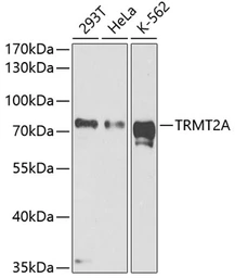 Anti-HTF9C antibody used in Western Blot (WB). GTX65946