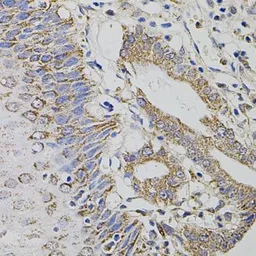 Anti-HTF9C antibody used in IHC (Paraffin sections) (IHC-P). GTX65946