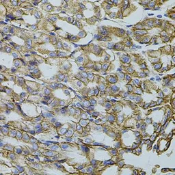 Anti-HTF9C antibody used in IHC (Paraffin sections) (IHC-P). GTX65946