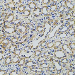 Anti-HTF9C antibody used in IHC (Paraffin sections) (IHC-P). GTX65946