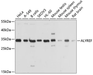 Anti-ALY antibody used in Western Blot (WB). GTX65947