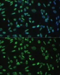 Anti-ALY antibody used in Immunocytochemistry/ Immunofluorescence (ICC/IF). GTX65947