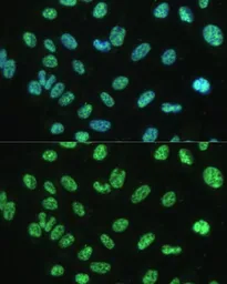 Anti-ALY antibody used in Immunocytochemistry/ Immunofluorescence (ICC/IF). GTX65947
