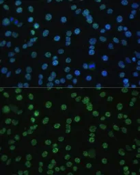Anti-ALY antibody used in Immunocytochemistry/ Immunofluorescence (ICC/IF). GTX65947
