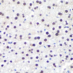 Anti-ALY antibody used in IHC (Paraffin sections) (IHC-P). GTX65947