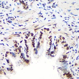 Anti-ALY antibody used in IHC (Paraffin sections) (IHC-P). GTX65947