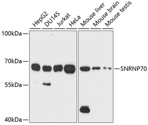 Anti-U1 snRNP70 antibody used in Western Blot (WB). GTX65948