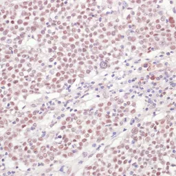 Anti-U1 snRNP70 antibody used in IHC (Paraffin sections) (IHC-P). GTX65948
