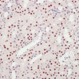 Anti-U1 snRNP70 antibody used in IHC (Paraffin sections) (IHC-P). GTX65948