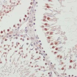 Anti-U1 snRNP70 antibody used in IHC (Paraffin sections) (IHC-P). GTX65948