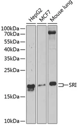 Anti-Sorcin antibody used in Western Blot (WB). GTX65950