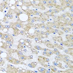 Anti-Sorcin antibody used in IHC (Paraffin sections) (IHC-P). GTX65950