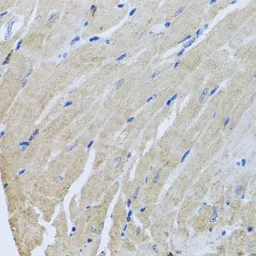 Anti-Sorcin antibody used in IHC (Paraffin sections) (IHC-P). GTX65950