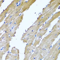 Anti-Sorcin antibody used in IHC (Paraffin sections) (IHC-P). GTX65950