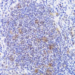 Anti-NASP antibody used in IHC (Paraffin sections) (IHC-P). GTX65952