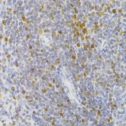 Anti-NASP antibody used in IHC (Paraffin sections) (IHC-P). GTX65952