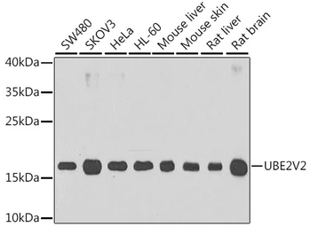 Anti-MMS2 antibody used in Western Blot (WB). GTX65953