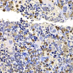 Anti-MMS2 antibody used in IHC (Paraffin sections) (IHC-P). GTX65953