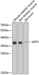 Anti-ART5 antibody used in Western Blot (WB). GTX65955