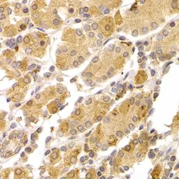 Anti-ART5 antibody used in IHC (Paraffin sections) (IHC-P). GTX65955