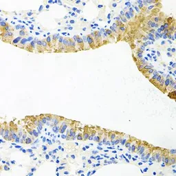 Anti-TOB2 antibody used in IHC (Paraffin sections) (IHC-P). GTX65957