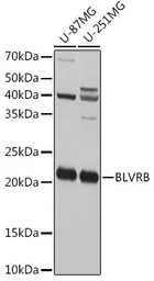 Anti-Flavin reductase antibody used in Western Blot (WB). GTX65958