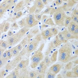 Anti-Flavin reductase antibody used in IHC (Paraffin sections) (IHC-P). GTX65958