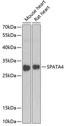Anti-TSARG2 antibody used in Western Blot (WB). GTX65960