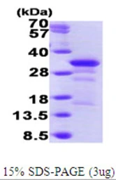 Human WIBG protein, His tag. GTX65961-pro